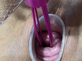 Mature spouse fucking cervix and penetration in uterus